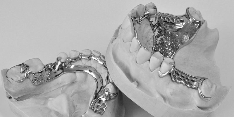 CHROME DENTURES